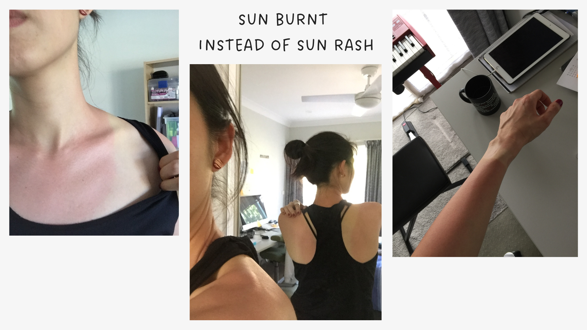 Sun-Burnt Sun Burnt